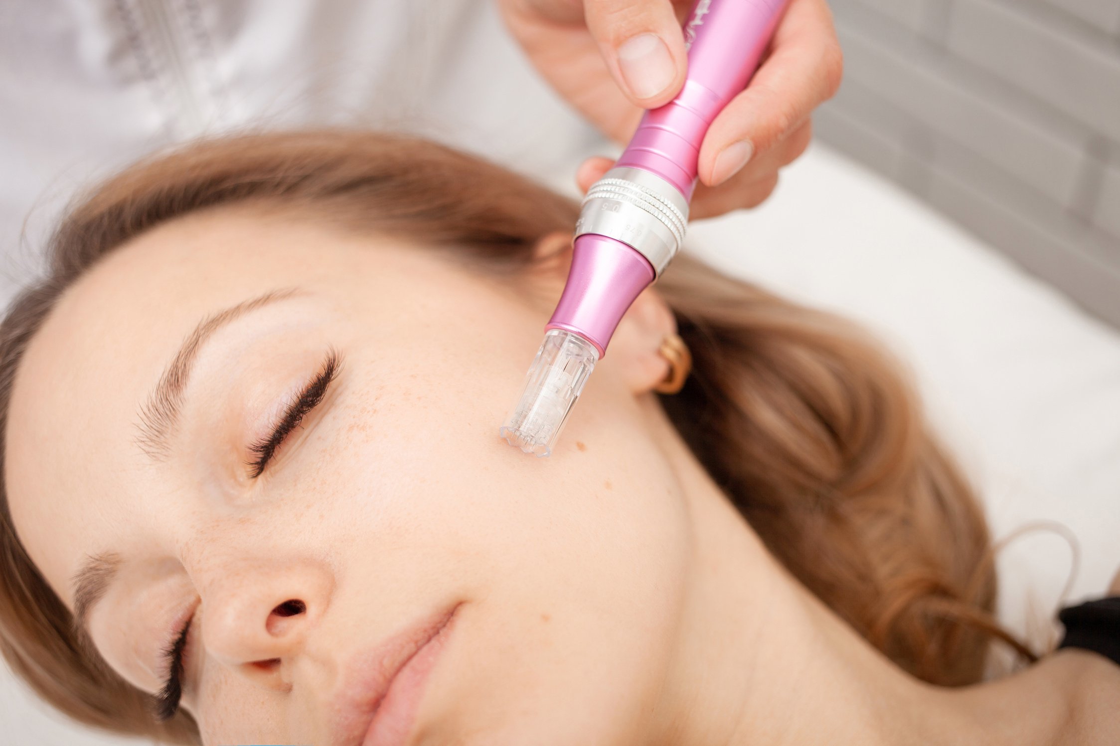 Mesotherapy in salon, cosmetologist, microneedles for rejuve